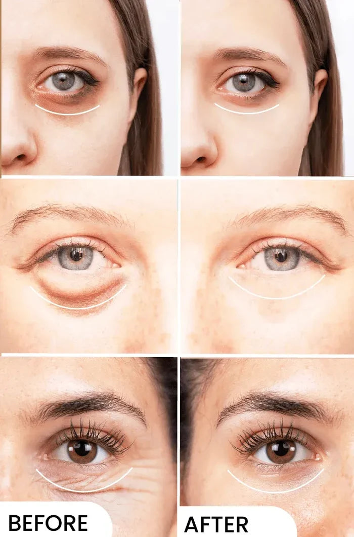 Eyelight Pack of 2 - Eliminates Dark Circles
