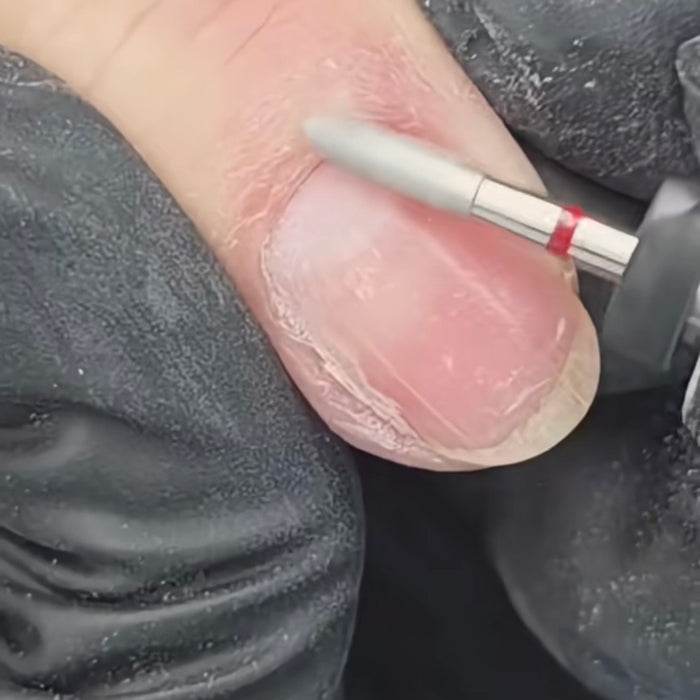 KB Pointed Skin Polishing E-File Bit